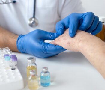 Choroby skóry u dzieci – jak się je rozpoznaje i leczy?