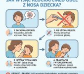 Infografika medyczna dla rodziców: instrukcja pierwszej pomocy, jak bezpiecznie wyjąć klocka lub ciało obce z nosa dzi...